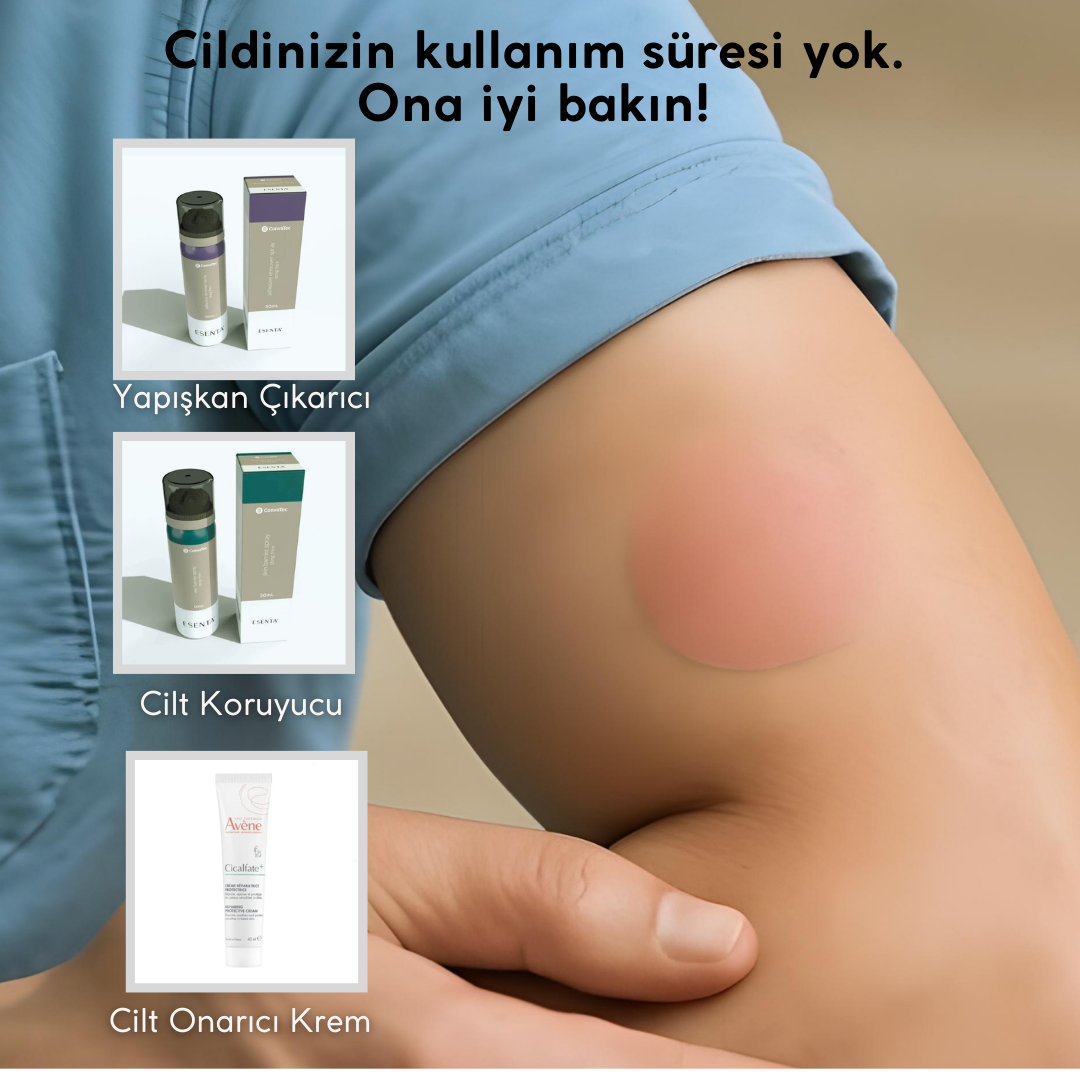 CGM Sensör Kullanırken Cilt Tahrişi Nasıl Önlenir?