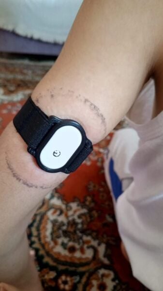 Sibionics Sensör Sabitleyici Tutucu (2 Adet)