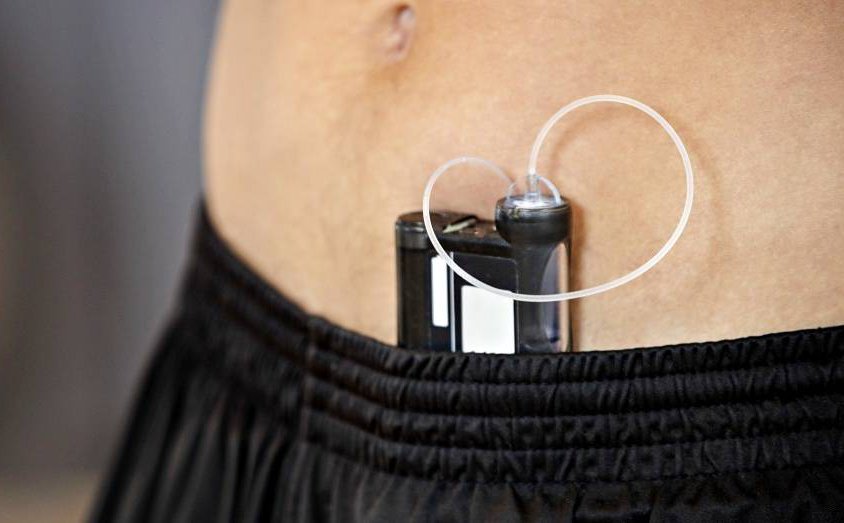 İnsülin Pompa Taşıma Çözümleri